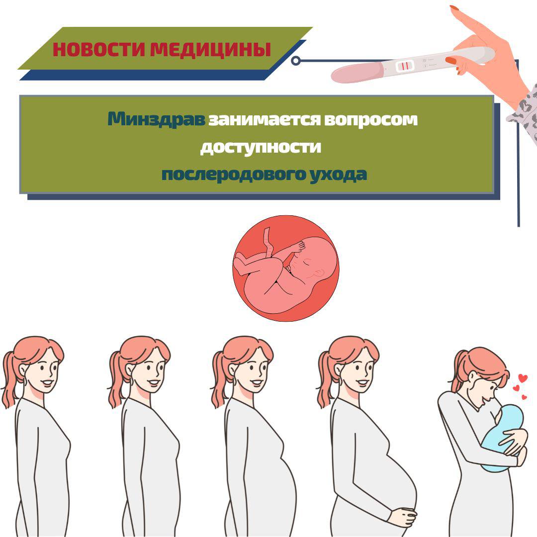 Послеродовой уход в Чехии